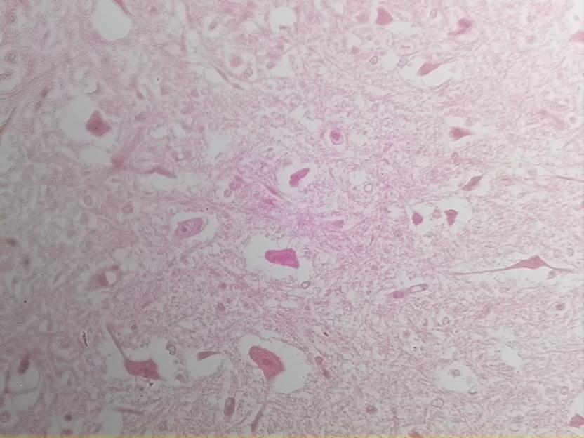 A single 40x tile of H&E-stained nervous tissue, one input to the stitching pipeline